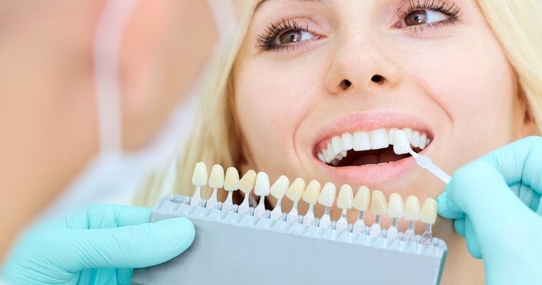 Dentist holding up different tooth shades for female patient